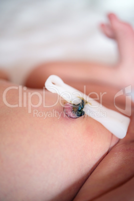 Umbilical cord with clamp of newborn baby