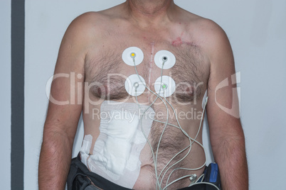 Upper body of a man with ECG electrodes