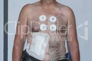 Upper body of a man with ECG electrodes