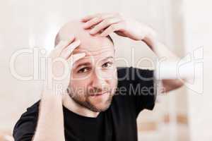 Bald man looking mirror at head baldness and hair loss