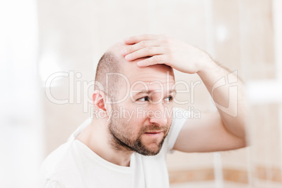 Bald man looking mirror at head baldness and hair loss