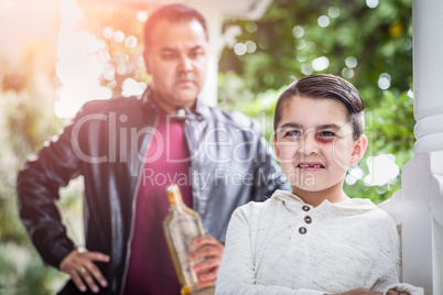 Afraid and Bruised Mixed Race Boy In Front of Angry Man