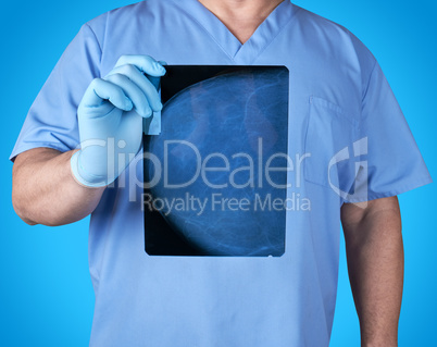 doctor in blue uniform and latex gloves holding an x-ray of a pa
