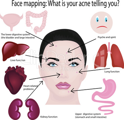 Face mapping. What your acne telling you info-graphic