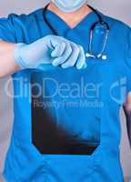 doctor in blue uniform and latex gloves holding a bone X-ray