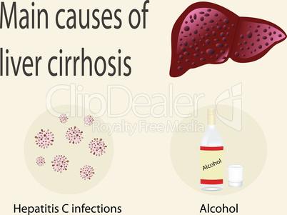 Main causes of liver cirrhosis