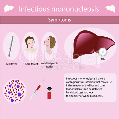 Symptoms of Infectious mononucleosis.