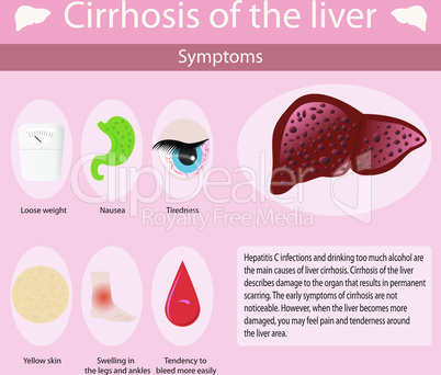 Symptoms of cirrosis of the liver.