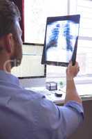 Male doctor looking at x ray in clinic