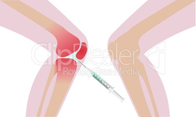 Knee injection inflamation redness vector illustration