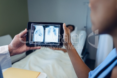 Male and female doctors looking at x-ray report on digital tablet in the ward