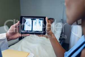 Male and female doctors looking at x-ray report on digital tablet in the ward