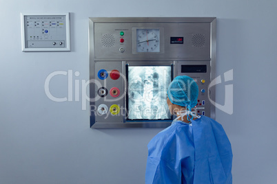 Female surgeon examining x ray on x-ray light box at hospital