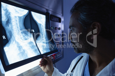 Mature male doctor examining x-ray on x-ray light box in operation room at hospital