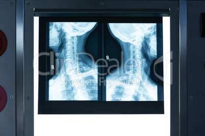X-ray light box in operating room
