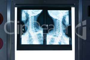 X-ray light box in operating room