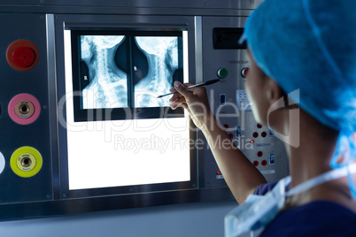 Female surgeon examining x-ray on a light box in the hospital