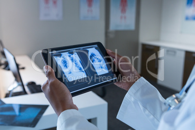 Female doctor examining x-ray on digital tablet in the hospital