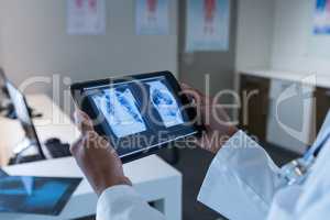 Female doctor examining x-ray on digital tablet in the hospital