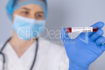 Nurse holding test tube with Positive Coronavirus test blood sam