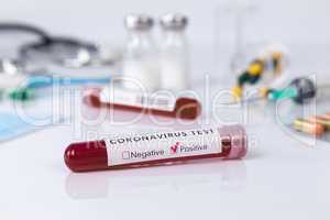 Blood test tube with the Coronavirus disease for virus test and