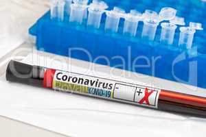 Positive Coronavirus Blood Test Tube Laying on Lab Table