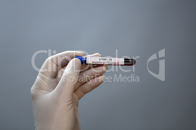 Coronavirus testing - A hand holds a test tube containing a patients sample that has tested positive for coronavirus