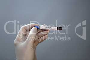 Coronavirus testing - A hand holds a test tube containing a patients sample that has tested positive for coronavirus