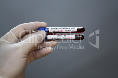 Coronavirus testing. A hand holds test tubes with coronavirus results.