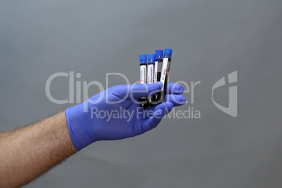 Coronavirus testing - a hand holds test tubes containing patient blood samples with results for coronavirus