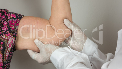 surgeon doing a medical check up by palpating the forearm, on adipose tissues, cellulite, on a female patient with, seen from the front