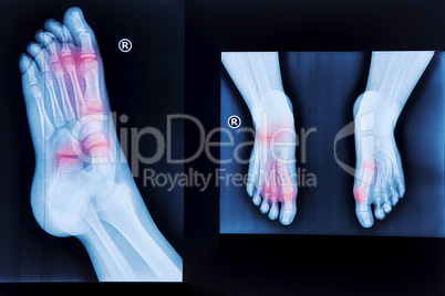 X-ray of human foot and pair of feet from different views