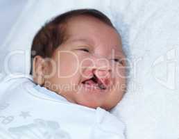 Hoping her cries dont go unheard. Closeup shot of a baby girl with a cleft palate.