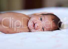 She wont let her birth defect get her down. Portrait of a baby girl with a cleft palate lying on a bed.