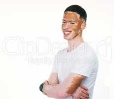 My skin doesnt define me. Portrait shot of a handsome young man with vitiligo posing with his arms folded on a white background.