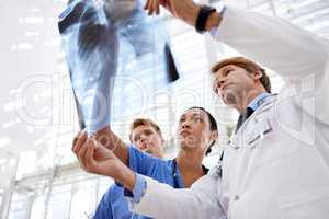 Examining the xrays. A medical team looking at can xray.