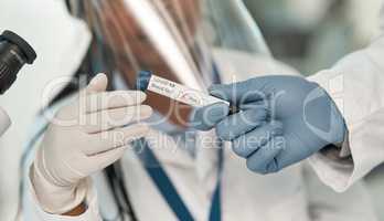 The result is confirmed. Closeup shot of an unrecognisable scientist holding a blood filled test tube labelled with a positive Covid-19 test result.