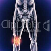 When inflammation strikes. A cgi view of an inflamed joint isolated on blue.