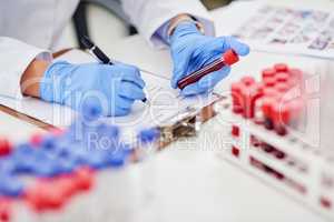 Compiling a detailed report of the latest findings. Closeup shot of a scientist examining a blood sample and recording findings in a lab.