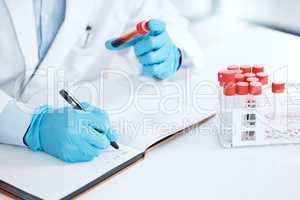 Hands of a scientist writing notes about a research sample, holding a test tube. Scientist working on chemistry experiment, holds vial of blood. Medical expert planning, holding tube of chemicals