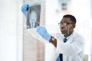 Heading towards a medical marvel. a young doctor analysing an x ray of a patients skull.