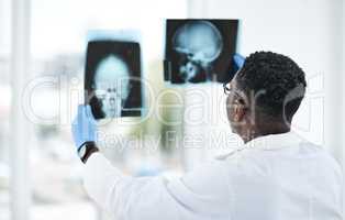 The master in matters of the mind. a young doctor analysing an x ray of a patients skull.