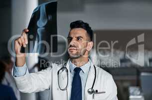 Bone health is what he knows best. a young doctor reading the results of an X-ray in a hospital.