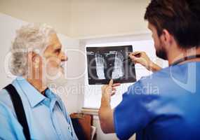 Your x-ray shows no major fractures, youll recover pretty quickly. a young doctor and his senior patient looking at an x-ray together.