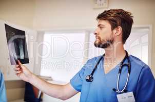 Hes trying to figure out a diagnostic. a young doctor analyzing an x-ray alone in his office.