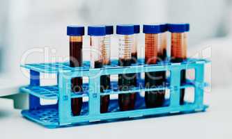 Closeup blood, test tube or medical research in science laborary for testing, checking or examining DNA sample. Searching for breakthrough cure for marburg virus, monkeypox or global pandemic disease